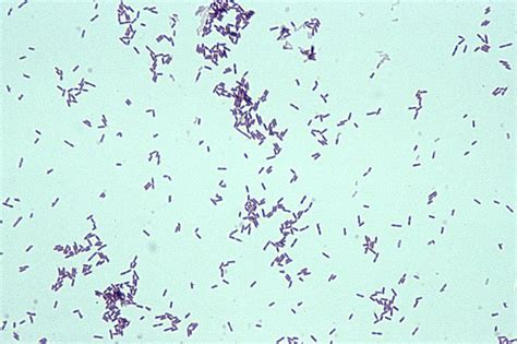 Vidas listeria monocytogenes (lmx) assay kit (37). Gram-Positive Bacilli (Rods) - Microbiology learning: The ...