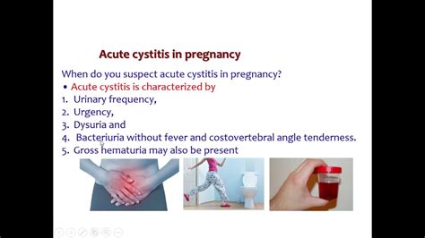 Lecture 13 Uti With Pregnancy Youtube