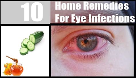 Easy And Effective Home Remedies For Eye Infection Netmarkers