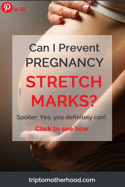 How To Prevent Pregnancy Stretch Marks 10 Easy Steps That Work
