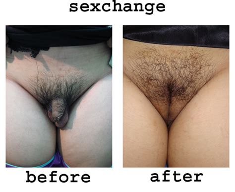 Sex Change After Photos Xxx Porn Library