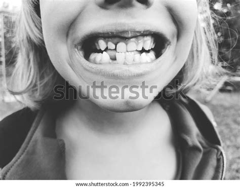 Loss Milk Teeth 6yearold Girl Smiles Stock Photo 1992395345 Shutterstock