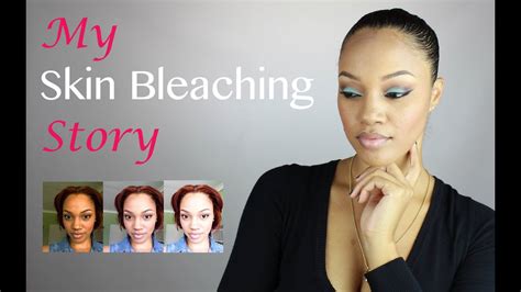 My Skin Bleaching Story Youtube