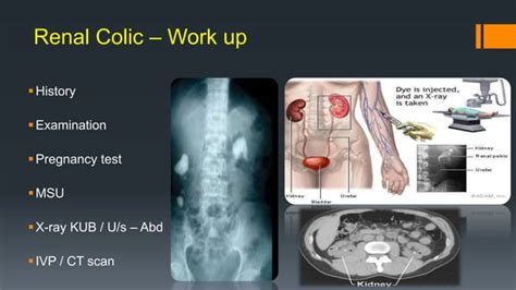 Common Urological Emergencies