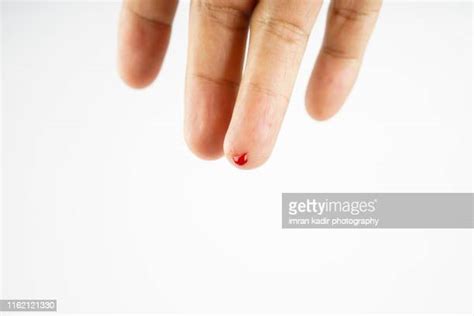 Bloody Finger Photos And Premium High Res Pictures Getty Images