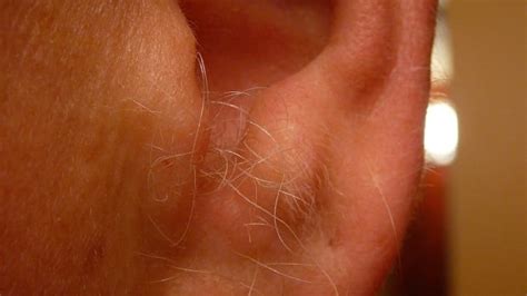 Why Does Ear Hair Grow As Men Age Cbc Radio