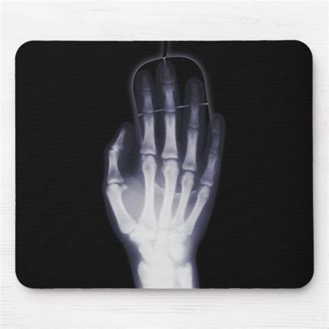 Funny Hand X Ray For Internet Addictioner Mouse Pad