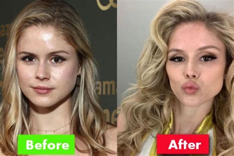 Erin Moriarty Before And After Plastic Surgery Her Transformation Journey