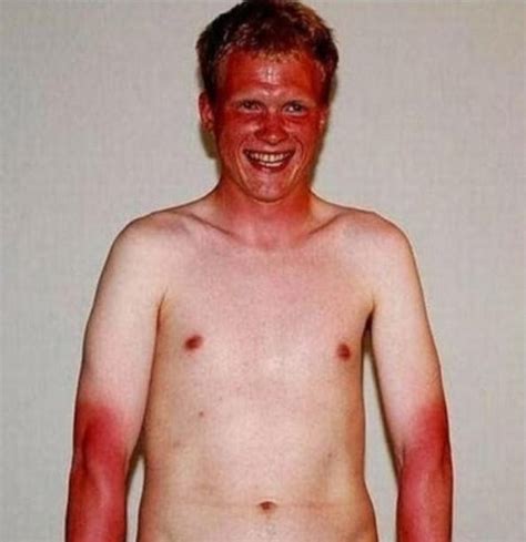 Tanning Fails Don T Get Much Worse Than This Pics