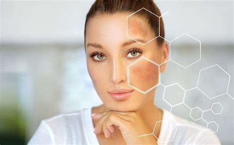 Laser Skin Whitening Treatment Protocols Aestha Clinic
