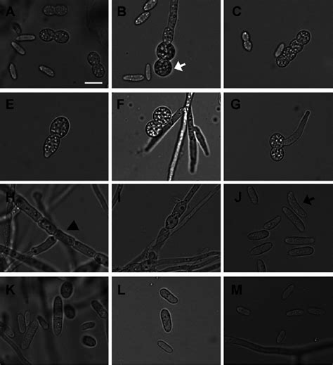 Assay Of Chlamydospore Formation From Conidia Of Cylindrocarpon