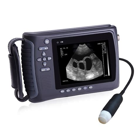 Buy 2022 Newest Ultrasound Machine For Pregnancy Portable Ecografo