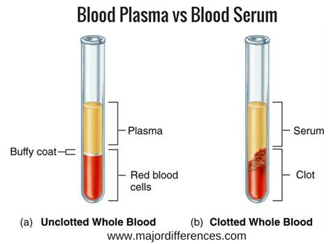 Difference Between Blood Serum And Blood Plasma Blood Serum Vs Blood