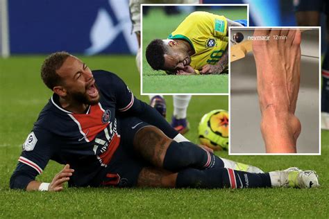 Neymars Injuries Through The Years From Ruptured Ankle Ligaments To