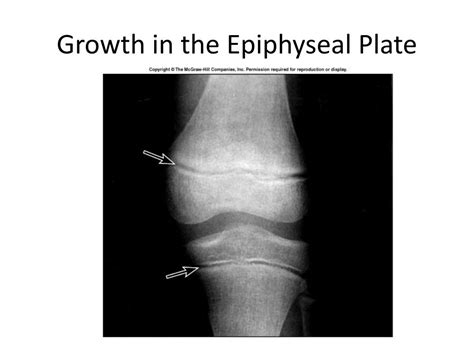 Ppt Cartilage Tissue Powerpoint Presentation Free Download Id1589961