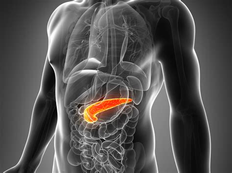 Acute Pancreatitis May Reveal Pancreatic Cancer At Earlier Stage The