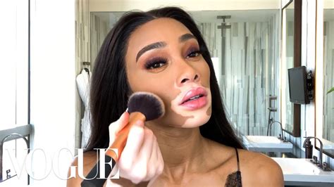 Meet The First Model With Vitiligo To Walk In The Victorias Secret