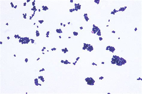 Gram Positive Cocci Microbiology Learning The Whyology Of