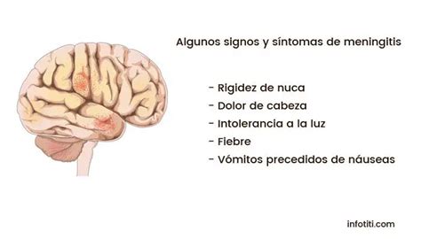 Qu Es La Meningitis Concepto Cuadro Cl Nico Y Tratamiento Neurolog A
