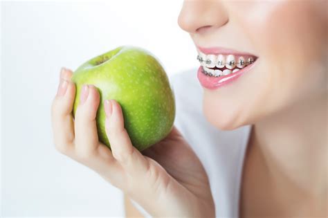 tips for eating with braces the insidexpress