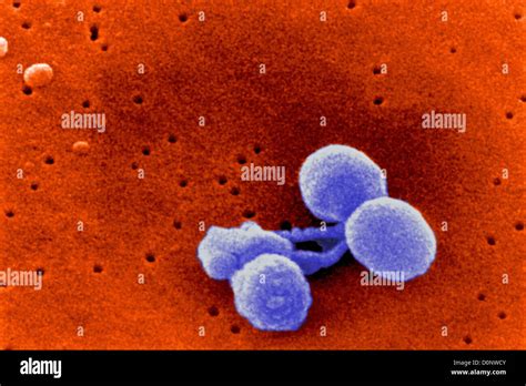 A Scanning Electron Micrograph Streptococcus Pneumoniae Nasty Bactrium