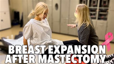 Breast Expansion After Double Mastectomy Youtube