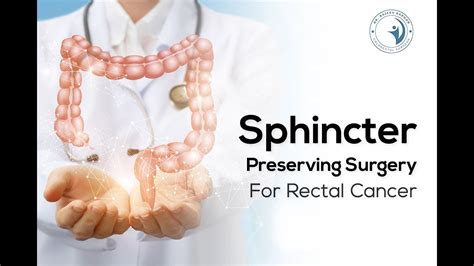 Sphincter Preserving Surgery For Rectal Cancer Colorectal Cancer Surgeon Dr Rajeev Kapoor