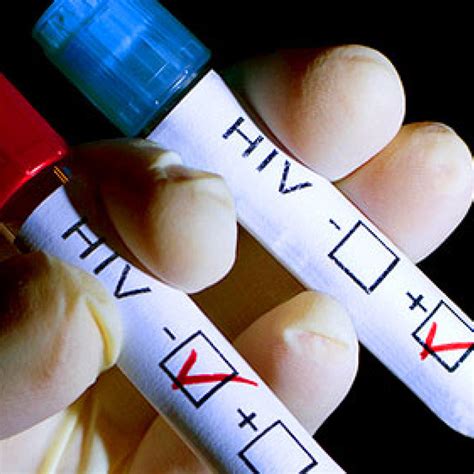 No sábado acabam os exames. HIV | Laboratório Bioanálise - Exames Laboratoriais