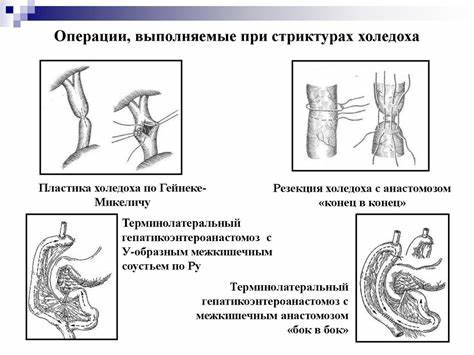 Диета при механическая желтуха Механическая желтуха - презентация онлайн Механическая желтуха - презентация онлайн Диета при механическая желтуха
