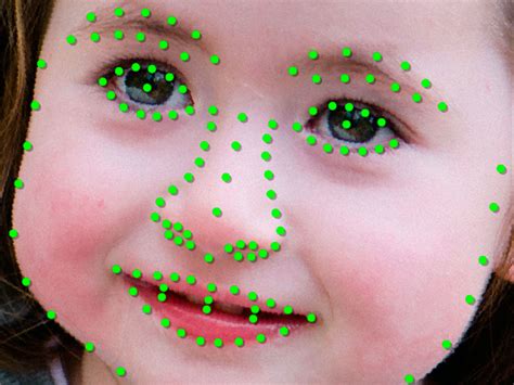 Deep Learning Ai Detects Rare Genetic Disorders By Scanning Faces The