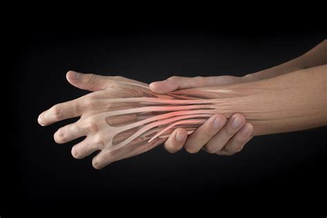 Extensor Tendonitis Causes Recovery And Prevention