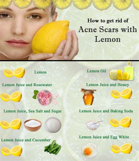 How To Get Rid Of Acne Scars With Lemon