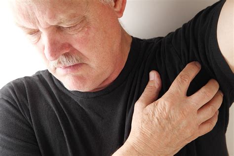 Armpit Boil Symptoms Causes Images Painful Staph