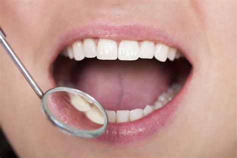 4 Causes For Discolored Tongue And What To Do About It Dentist In