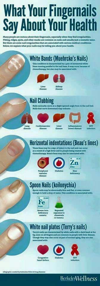 Nail Signs Fingernail Health Health Facts Health Remedies