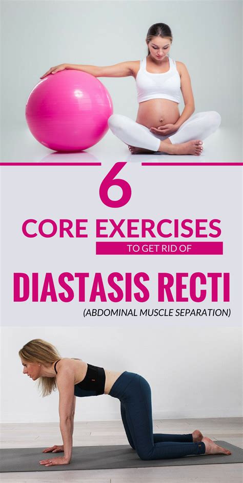 6 Core Exercises To Get Rid Of Diastasis Recti Abdominal Muscle