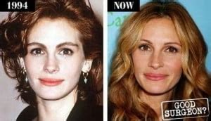 Julia Roberts Plastic Surgery Is The Pretty Woman All Natural