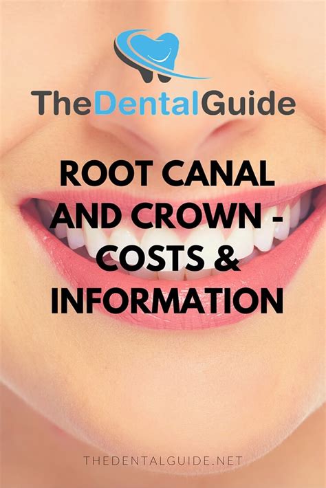 Many people fear root canals because they think they are painful during or after. Root Canal and Crown - Costs & Information - The Dental Guide