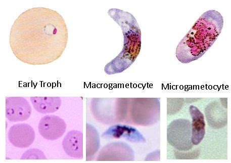 Plasmodium Falciparum Parasitology Class Id Pictures Names Only