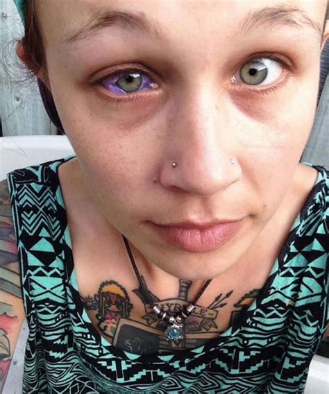 Galen, a roman physician and philosopher, was practicing the procedure, specifically known as corneal tattooing, to hide leucomata (opaque area or scar of the cornea) of the eye. 10 Extreme Eyeball Tattoos That Look Incredibly Painful