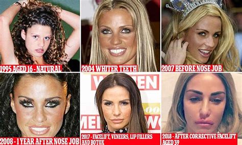Katie Prices Dramatic Transformation From Fresh Faced Teenager Daily