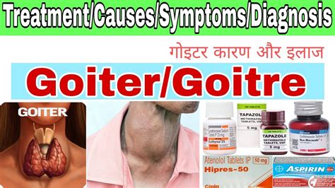 Goiter Treatment In Hindi Goitre Treatmentsymptomscausesdiagnosis