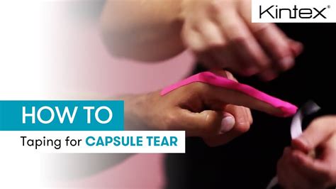 How To Kinesiology Taping On Finger Capsule Tear Youtube