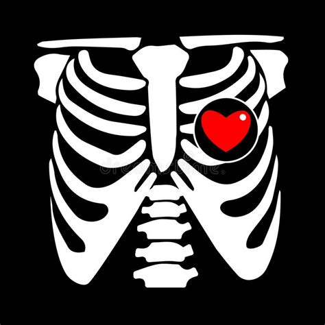 Chest X Ray Illustration Illustration Of Many Recent Choices