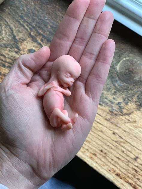 Miscarried Human Fetus