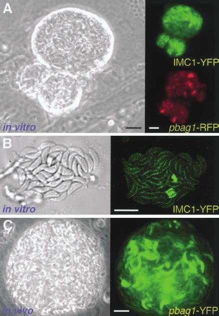 Fluorescent Bradyzoites In Vitro And In Vivo A Phase Contrast Image