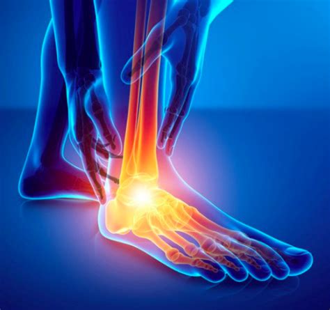 Tingling In The Toes Tarsal Tunnel Syndrome — Dynamic Physio Therapy