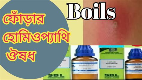 Boils Treatment In Homeopathyabcess Homeopathy Medicine Youtube