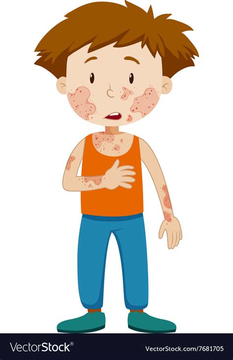 Boy With Infectious Disease Royalty Free Vector Image