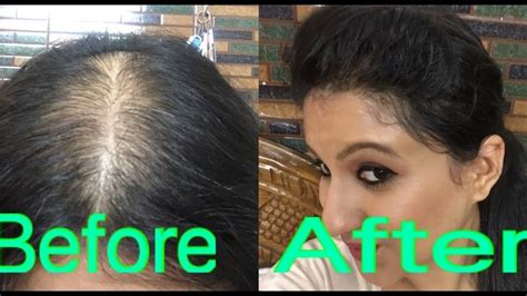 Actual this hairstyle involves some tricks there is no shampoo and condition your hair with thorough rinsing. Hairstyle For Balding Crown For Women With Thin Curly Hair ...